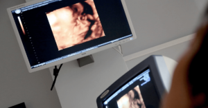 ultrasound scan in Miami