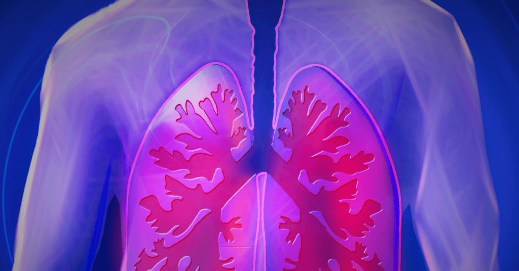 pulmonary embolism diagnosis in Miami