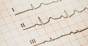 heart ultrasound near miami